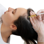 PRP for Hair Regrowth